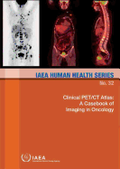 Clinical PET/CT Atlas: A Casebook of Imaging in Oncology