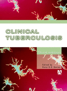 Clinical Tuberculosis