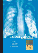 Clinical Tuberculosis