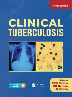 Clinical Tuberculosis - Davies, Peter D O (Editor), and Gordon, Stephen B (Editor), and Davies, Geriant (Editor)