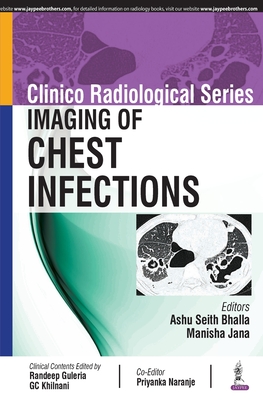 Clinico Radiological Series: Imaging of Chest Infections - Bhalla, Ashu Seith, and Jana, Manisha, and Naranje, Priyanka