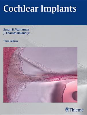 Cochlear Implants - Waltzman, Susan B (Editor), and Roland, J Thomas (Editor)