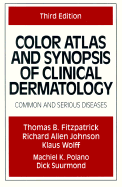 Color Atlas and Synopsis of Clinical Dermatology: Common and Serious Diseases - Fitzpatrick, Thomas B, and Wolff, Klaus, M.D., and Johnson, Richard Allen