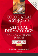Color atlas and synopsis of clinical dermatology : common and serious diseases.