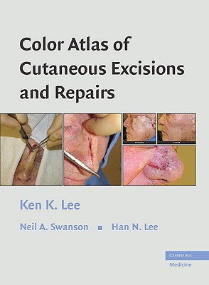 Color Atlas of Cutaneous Excisions and Repairs - Lee, Ken K, and Swanson, Neil A, and Lee, Han N