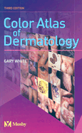 Color Atlas of Dermatology