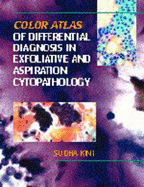 Color Atlas of Differential Diagnosis in Exfoliative and Aspiration Cytopathology - Kini, Sudha R, and Kini, Suda R, and Kini, Sugha R