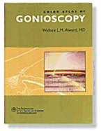 Color Atlas of Gonioscopy - Alward, Wallace L M
