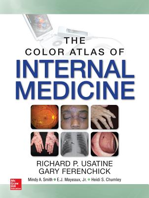 Color Atlas of Internal Medicine - Usatine, Richard, and Ferenchick, Gary, and Smith, Mindy Ann