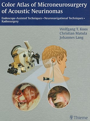 Color Atlas of Microneurosurgery of Acoustic Neurinomas: Endoscope-Assisted Techniques - Neuronavigational Techniques - Radiosurgery - Koos, Wolfgang T, and Matula, Christian, and Lang, Johannes