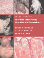 Color Atlas of Vascular Tumors and Vascular Malformations