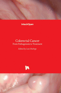 Colorectal Cancer: From Pathogenesis to Treatment