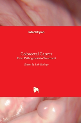 Colorectal Cancer: From Pathogenesis to Treatment - Rodrigo, Luis (Editor)
