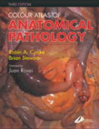 Colour Atlas of Anatomical Pathology - Cooke, Robin A, Professor, OBE, MD, and Stewart, Brian