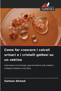 Come far crescere i calcoli urinari e i cristalli gottosi su un vetrino