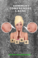 Comment comprendre l'acn?