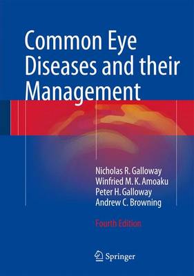 Common Eye Diseases and their Management - Galloway, Nicholas R., and Amoaku, Winfried M. K., and Galloway, Peter H.