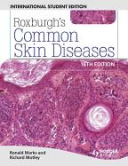 Common Skin Diseases