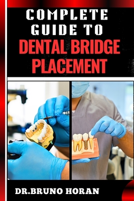 Complete Guide to Dental Bridge Placement: Comprehensive Manual To Restoring Smiles, Improving Oral Health, And Ensuring Long Lasting Tooth Solutions - Horan, Bruno, Dr.