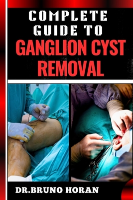 Complete Guide to Ganglion Cyst Removal: Comprehensive Handbook To Expert Techniques, Home Remedies, And Post Surgery Care For Pain Relief And Healing - Horan, Bruno, Dr.