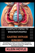 Complete Guide to Understanding Gastric Bypass Surgery: Everything You Need To Know About Procedure, Recovery, Risks, Success Factors For Weight Loss And Improved Health