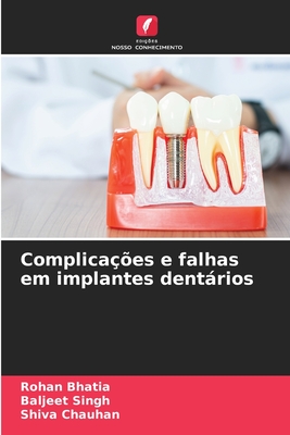 Complica??es e falhas em implantes dentrios - Bhatia, Rohan, and Singh, Baljeet, and Chauhan, Shiva