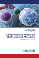 Comprehensive Review on Oral Lichenoid Mucositis