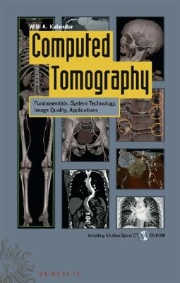 Computed Tomography: Fundamentals, System Technology, Image Quality, Applications - Kalender, Willi A