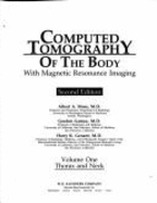 Computed tomography of the body with magnetic resonance imaging