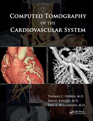 Computed Tomography of the Cardiovascular System - Gerber, Thomas C. (Editor), and Kantor, Birgit (Editor), and Williamson, Eric E. (Editor)