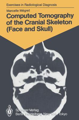 Computed Tomography of the Cranial Skeleton (Face and Skull): 58 Radiological Exercises for Students and Practitioners - Megret, Marcelle, and Wackenheim, Marie-Therese (Translated by)