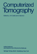 Computerized tomography