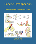 Concise Orthopaedic Notes: Revision aid for FRCS, EBOT , SICOT and Board Examinations