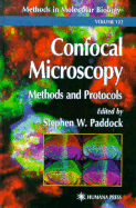 Confocal Microscopy: Methods and Protocols