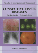 Connective Tissue Diseases