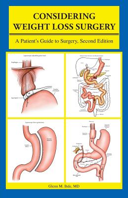 Considering Weight Loss Surgery: A Patient's Guide to Surgery, Second Edition - Ihde, Glenn M, MD