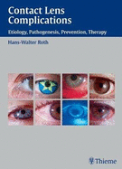 Contact Lens Complications: Etiology, Pathogenesis, Prevention, Therapy