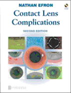 Contact Lens Complications