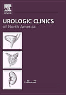 Contemporary Issues with Bladder Cancer, an Issue of Urologic Clinics: Volume 32-2 - Stone, John H, and Resnick, Martin I