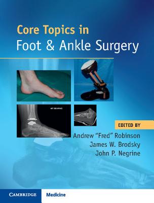 Core Topics in Foot and Ankle Surgery - Robinson, Andrew, Dr. (Editor), and Brodsky, James W (Editor), and Negrine, John P (Editor)