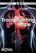 Nova: Transplanting Hope Dvd