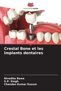 Crestal Bone et les implants dentaires