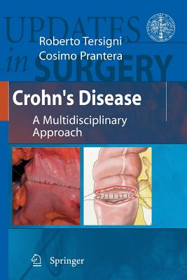 Crohn's Disease: A Multidisciplinary Approach - Tersigni, Roberto (Editor), and Prantera, Cosimo (Editor)