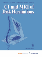 CT and MRI of disk herniations