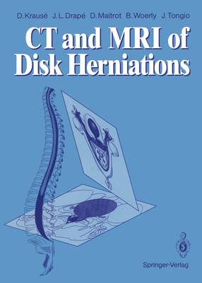 CT and MRI of Disk Herniations - Krause, Denis, and Picard, Luc (Foreword by), and Drape, Jean L