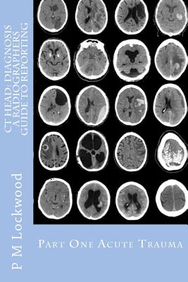 CT Head: Diagnosis a Radiographers Guide to Reporting Part 1 Acute ...