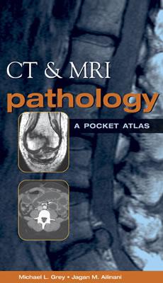 CT & MRI Pathology: A Pocket Atlas - Grey, Michael L, and Ailinani, Jagan M