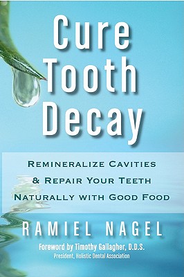 Cure Tooth Decay: Remineralize Cavities and Repair Your Teeth Naturally with Good Food - Nagel, Ramiel, and Gallagher, D D S Timothy (Foreword by)