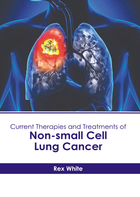 Current Therapies and Treatments of Non-Small Cell Lung Cancer - White, Rex (Editor)