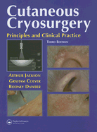 Cutaneous Cryosurgery: Principles and Clinical Practice